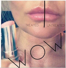 Load image into Gallery viewer, Lip Plumping Balm