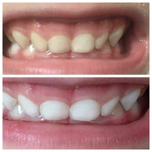 Load image into Gallery viewer, Whitening Toothpaste by Nuskin Available With Fluoride Or Fluoride Free | DIBS BRIGHT Fluoride or Fluoride Free