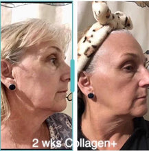 Load image into Gallery viewer, LumiSpa + 10 days of Collagen DIBS 978