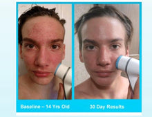 Load image into Gallery viewer, LumiSpa + 10 days of Collagen DIBS 978