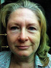 Load image into Gallery viewer, Body Shaping Bundle | DIBS BODY
