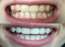 Load image into Gallery viewer, Whitening Toothpaste by Nuskin Available With Fluoride Or Fluoride Free | DIBS BRIGHT Fluoride or Fluoride Free
