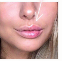 Load image into Gallery viewer, Lip Plumping Balm
