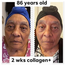 Load image into Gallery viewer, LumiSpa + 10 days of Collagen DIBS 978
