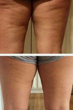 Load image into Gallery viewer, Body Shaping Bundle | DIBS BODY
