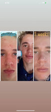 Load image into Gallery viewer, LumiSpa + 10 days of Collagen DIBS 978
