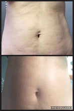 Load image into Gallery viewer, Body Shaping Bundle | DIBS BODY
