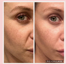 Load image into Gallery viewer, LumiSpa + 10 days of Collagen DIBS 978
